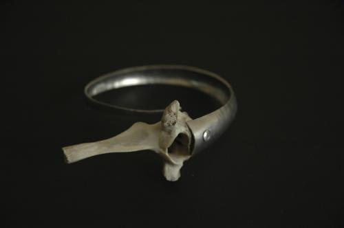 Bone and Aluminium